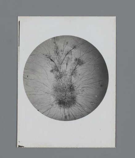 Photograph of a microscopic preparation