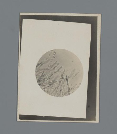 Photograph of a microscopic preparation