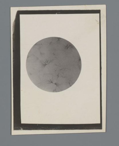 Photograph of a microscopic preparation