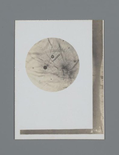 Photograph of a microscopic preparation