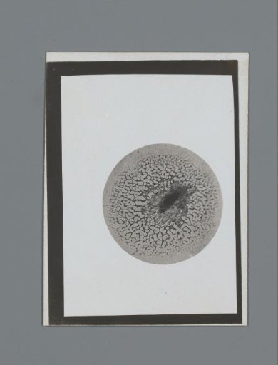 Photograph of a microscopic preparation