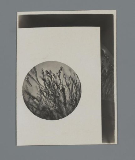 Photograph of a microscopic preparation