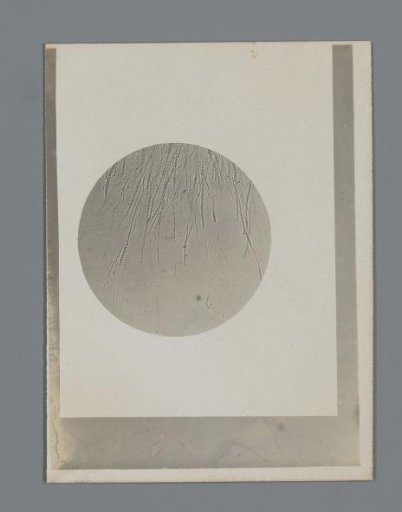 Photograph of a microscopic preparation