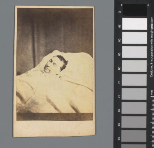 Post-mortem portrait of an unknown man