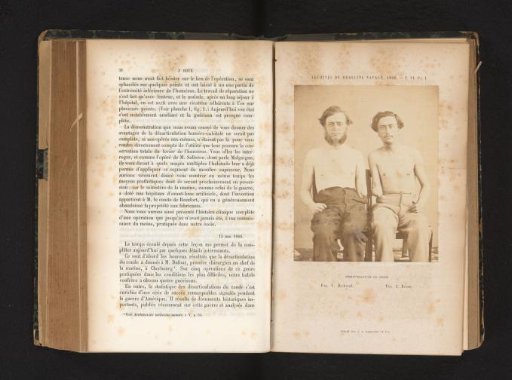 Portrait of two unknown men, designated as Reboul and Brun, both with amputated forearms