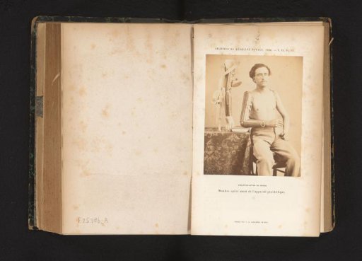 Portrait of an unknown man with an arm prosthesis