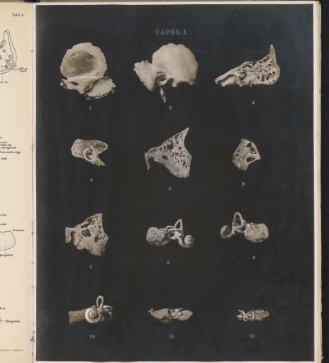 Twelve preparations and casts of the human ear and ear canal