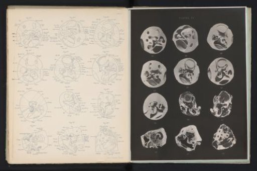 Twelve models and preparations of the human ear