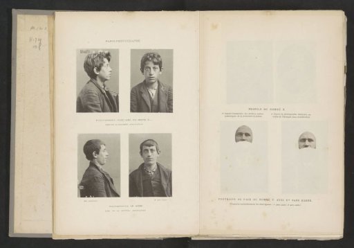 Portraits of a Juvenile Criminal, Made After His First and After His Second Arrest