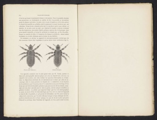 Lice