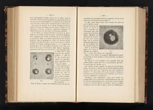 Four microscopic images of the human eye