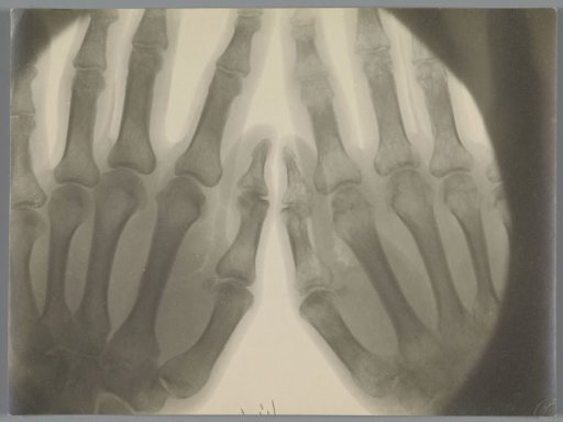 Pair of hands