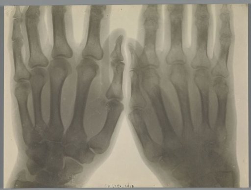 Pair of hands