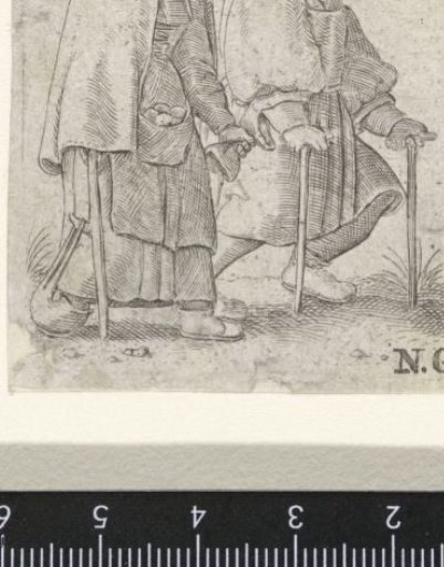 Man and woman walking on crutches