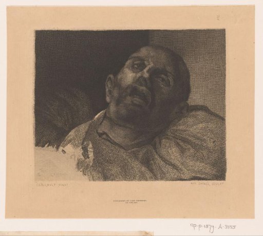 Head of a beheaded man