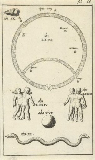 Anatomical Plate IV