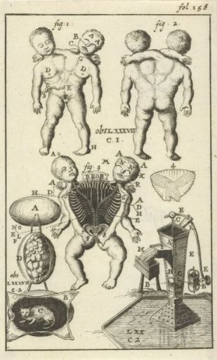 Anatomical Plate VI