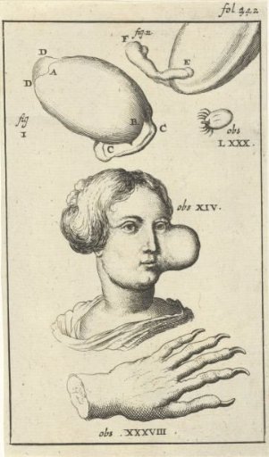 Anatomical Plate XI