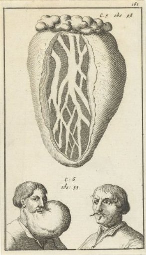 Anatomical Plate XIV