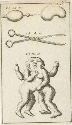 Anatomical Plate XV
