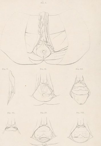 Anatomical Image of the Pelvis