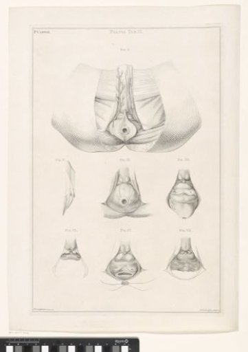Anatomy of the Pelvis