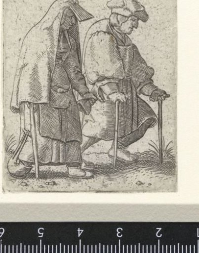 Man and woman walking on crutches