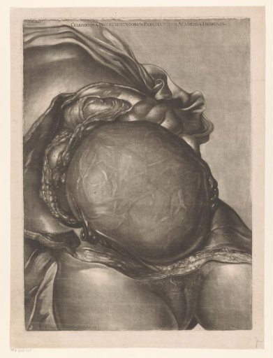 Anatomy of a woman with dissected abdomen and uterus