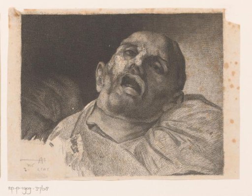 Head of a beheaded man