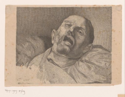 Head of a beheaded man
