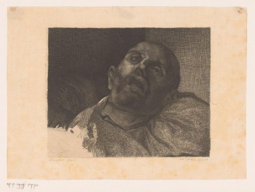 Head of a beheaded man