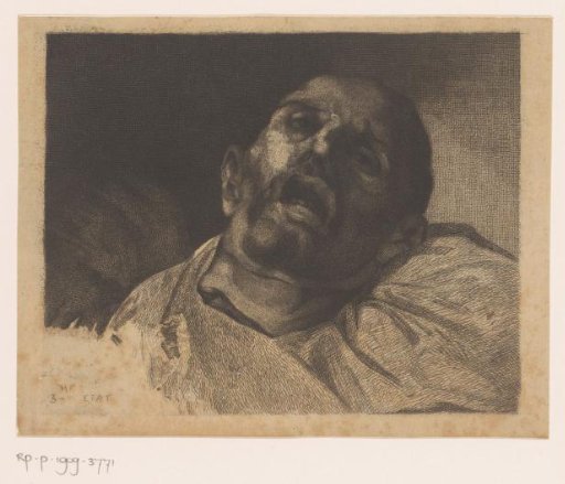 Head of a beheaded man