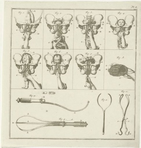 Gynecological illustrations