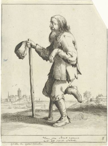Vagabond on Crutches