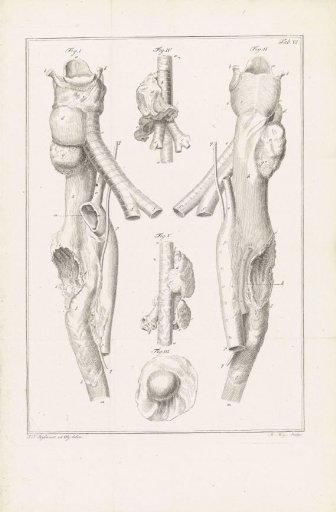Anatomical illustration