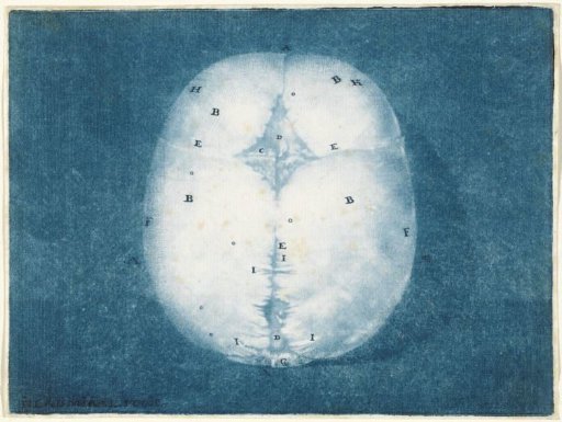 Plates of the Brain and the Heart