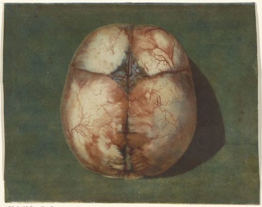 Anatomical Study of the Skull of an Unborn Child