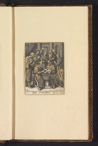 The Circumcision