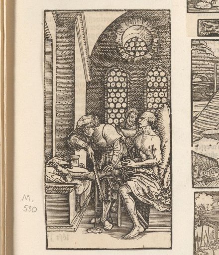 Amputation of a leg by means of a saw