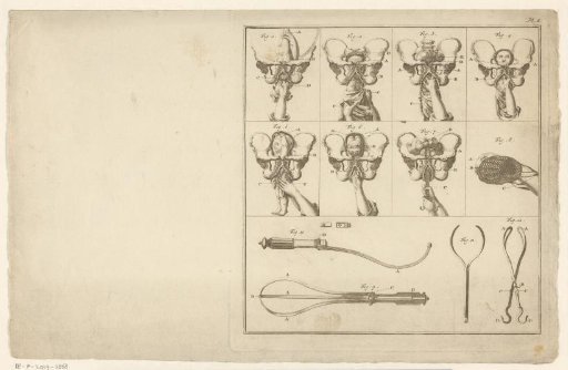 Eight views of the delivery of a baby