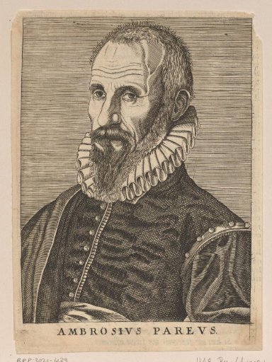 Portrait of Ambroise Paré