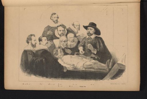 The Surgical Lesson. (Freely after Rembrandt.)