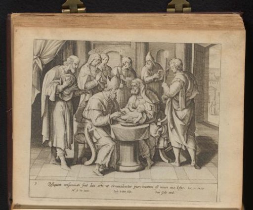 The Circumcision of Christ