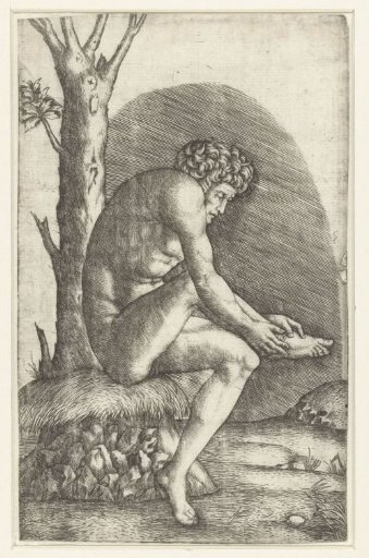 Seated naked man examining a wound on his foot