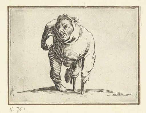 Little man (caricature) with a crutch and leg brace