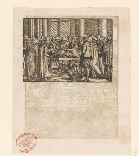 Anatomy Lesson