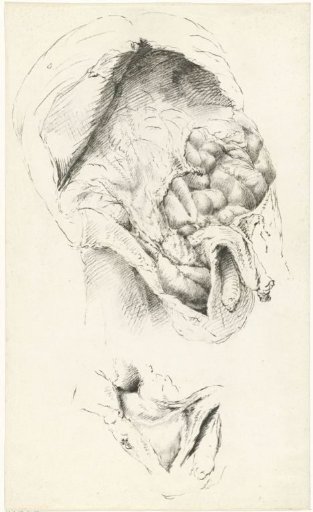 Dissected child's body