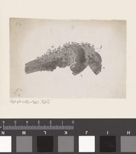 Human Bone with a Deformity