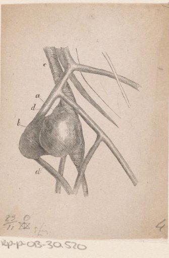 Part of the Human Body with a Deformity