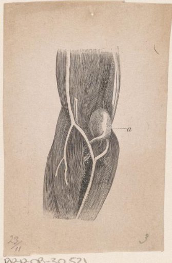 Part of the Human Body with a Deformity